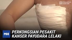 Tes payudara mamografi untuk deteksi dini kanker payudara. Perkongsian Pesakit Kanser Payudara Lelaki Mhi 9 Oktober 2020 Youtube