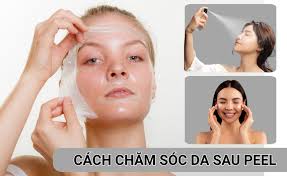 Cách Chăm Sóc Da Sau Peel Hiệu Quả, An Toàn Nhất | Kiehl's