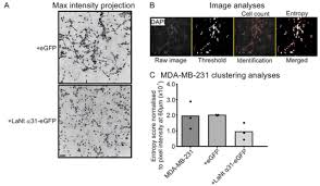 Mark ashe, university of manchester: Laminin N Terminus A31 Is Upregulated In Invasive Ductal Breast Cancer And Changes The Mode Of Tumour Invasion Biorxiv