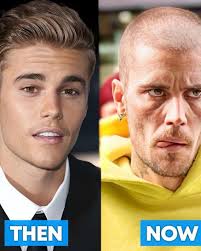 31 years old is the new 70