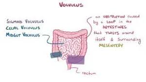 Image result for Volvulus