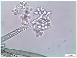 Image result for Botrytis cinerea