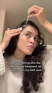 Rosemary working overtime while SAD, anxiety, and stress are taking over me  and causing hair loss 🥲 #miellerosemarymintoil #baldspottreatment  #hairlossfromstress