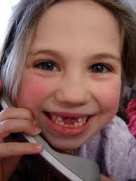 Is the tongue against the teeth or the roof of the mouth? Treatment Methods Of How To Get Rid Of A Lisp Cure Soon