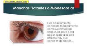 Puntos Que Flotan En La Vision Como Combatir Los Molestosos Puntos Que Flotan En La Vision Youtube