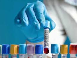 It is quite clear from the tables above that a routine blood work is able to diagnose blood cancers. Study Examines Whether Blood Test Can Identify Early Cancers National Cancer Institute