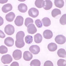 Siklus hidup parasit malaria 1. Malaria Parasites Malaria Site