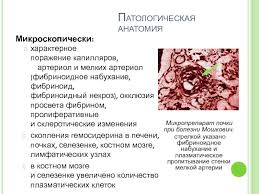 Особенности болезни советы опытных врачей медицинской клиники «добробут» не пропустите обновление рубрики! Tromboticheskaya Trombocitopenicheskaya Purpura Prezentaciya Doklad