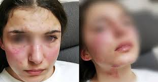 Majka pretučene djevojčice ogorčena na sistem: "Ovo je napravio otac, moje  srce ne postoji. Nisam ja odlučila da ga puste"