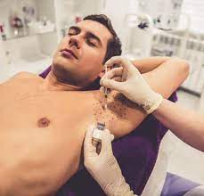 Lasers are able to target unwanted hair and permanently destroy hair follicles without causing damage to the surrounding skin. 3 Effective Hair Removal Techniques For Men To Get Rid Of Unwanted Body Hair Permanently