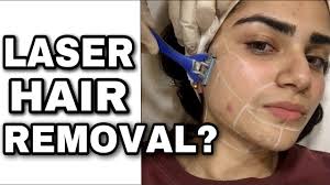 There are rare side effects after laser hair removal and include the following: I Tried Laser Hair Removal At Home Youtube