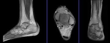 Each test is specifically tailored to your needs. Ankle Mri Protocols And Planning Indications For Ankle Mri Scan