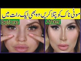 Moti Naak Ko Patla Or Beautiful Karne Ka Asan Nuskha Beautiful Nose No Surgery Youtube Surgery Health And Fitness Articles Health And Beauty Tips