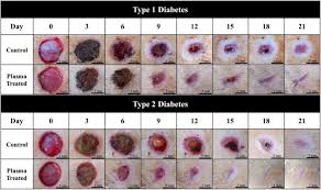 Abscesses are serious wounds that generally require a vet's attention and oral (or injected) antibiotics in order to heal fully, because the infection tends to run deep…too deep for topical medications to fully penetrate. Wound Healing In Streptozotocin Induced Diabetic Rats Using Atmospheric Pressure Argon Plasma Jet Scientific Reports