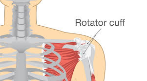 Pain around the shoulder blade and shoulder injuries can be very uncomfortable and are easily aggravated human body diagram printable on diagram site. Rotator Cuff Related Shoulder Pain Bassendean Physiotherapy