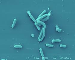 Image result for yersinia fotos