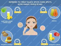 Pin On Elegance And Health Hacks