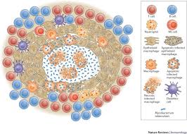 Ending tuberculosis is a race against time and drug resistance. Heterogeneity In Tuberculosis Nature Reviews Immunology