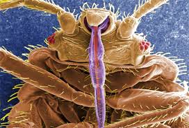 Ambler S Mr Bedbug Puts Big Money Into Bed Bug Killing Bed Liners For Philly S Infestations