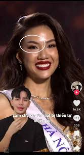 Chuyên gia nội khoa nghi ngờ Bùi Quỳnh Hoa căng chỉ mắt, tiêm filler để thi  hoa hậu