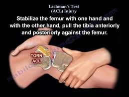 A network access control list (acl) is an optional layer of security for your vpc that acts as a firewall for controlling traffic in and out of one or more subnets. Lachman S Test Acl Injury Everything You Need To Know Dr Nabil Ebraheim Youtube