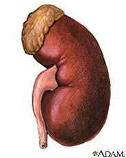 Which kidney is lower than the other and why? Kidney Diseases Medlineplus Kidney Transplant Kidney Failure Kidney Cyst Symptoms