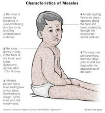 They are generally followed by branny desquamation of the cuticle in the position they have occupied. Measles Nursing Crib