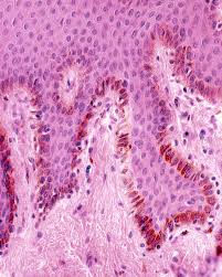 Image result for Melanocyte
