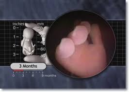 How to calculate how many weeks you are. 3 To 4 Months Prenatal Overview