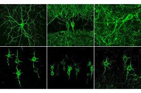 It is the main component of nervous tissue in all animals except sponges and placozoa. New Method Visualizes Groups Of Neurons As They Compute Mit News Massachusetts Institute Of Technology