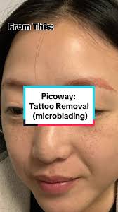 Augenbrauen Pmu Entfernen Orange