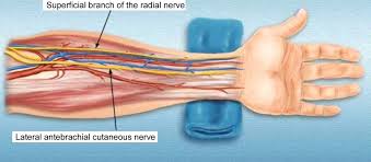 Radial Artery Harvest Nerves Cardiothoracic Surgery Arteries Anatomy And Physiology