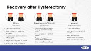 A hysterectomy removes a woman's uterus, usually constipation after a hysterectomy occurs for a number of reasons, most of which aren't entirely understood. Hysterectomy For Fibroids Ppt Download