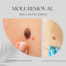 Skin cancer is the most common type of cancer in the united states by a pretty large margin, and it does not discriminate. Facebook