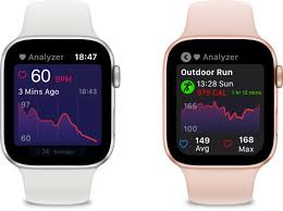 Heart Analyzer Overhauls Its Apple Watch App You Can Now