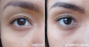 This delicate clinique undereye cream provides instant brightening and reduces dark circles over time. Crema Pentru Pleoape Clinique Even Better Eyes Dark Circle Corrector 10ml Pandashop Md CumpÄrÄ Crema Pentru Pleoape Clinique Even Better Eyes Dark Circle Corrector 10ml La Un PreÈ Avantajos In ChiÈinÄu Moldova