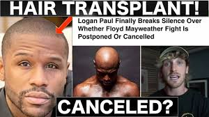 The exhibition match is scheduled for february 20, 2021. Floyd Mayweather Hair Transplant Update Beard Hair Transplant Cancels Fight Youtube