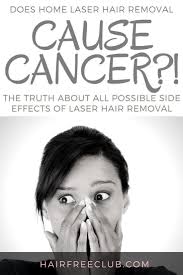 The way laser hair removal works is the concentrated beam of light that heats up any pigmentation in the hair and transfers that heat all the way down to the root of the hair follicle destroying it. The Hair Removal Experts Laser Hair Laser Hair Removal Hair Removal