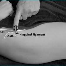 Image result for Pelvic Compression Test