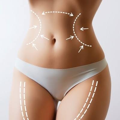Why Is Liposuction Uae a Long-Term Solution?
