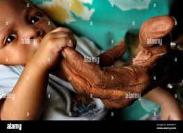 Bertha st hi-res stock photography and images