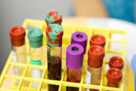 If you want the best rates and highest coverage amounts, you must go through with the tests. What Is A Life Insurance Blood Test Looking For
