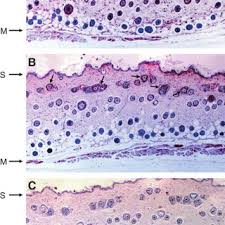 Pdf Proteoglycans In Normal And Healing Skin