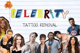 Pharrell is clearly willing to go to some pretty extreme measures to start fresh. All Celebrities That Got Their Tattoos Removed Tattoos Remove