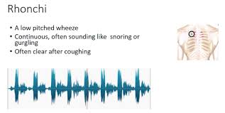 Basic Lung Sounds V2