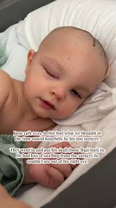 Archie Erwin What Happened