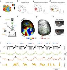 There's no standardization of lie. Focal Cortical Seizures Start As Standing Waves And Propagate Respecting Homotopic Connectivity Nature Communications