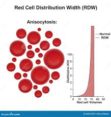 Image result for Red Cell Distribution Width