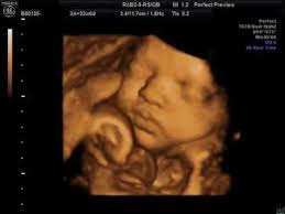Check spelling or type a new query. Beautiful Slideshow Of 3d Images Of Babies In The Womb Please Repin For Pregnant Mommies Perfect Prev 4d Ultrasound Ultrasound How To Memorize Things