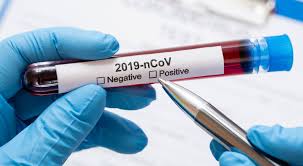 Wann bin ich an der reihe? Coronavirus Aktuelle Zahlen Fur Niederosterreich